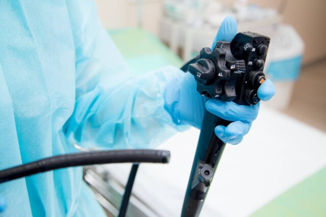 検診のバリウム検査と胃カメラはどちらを選ぶべき？