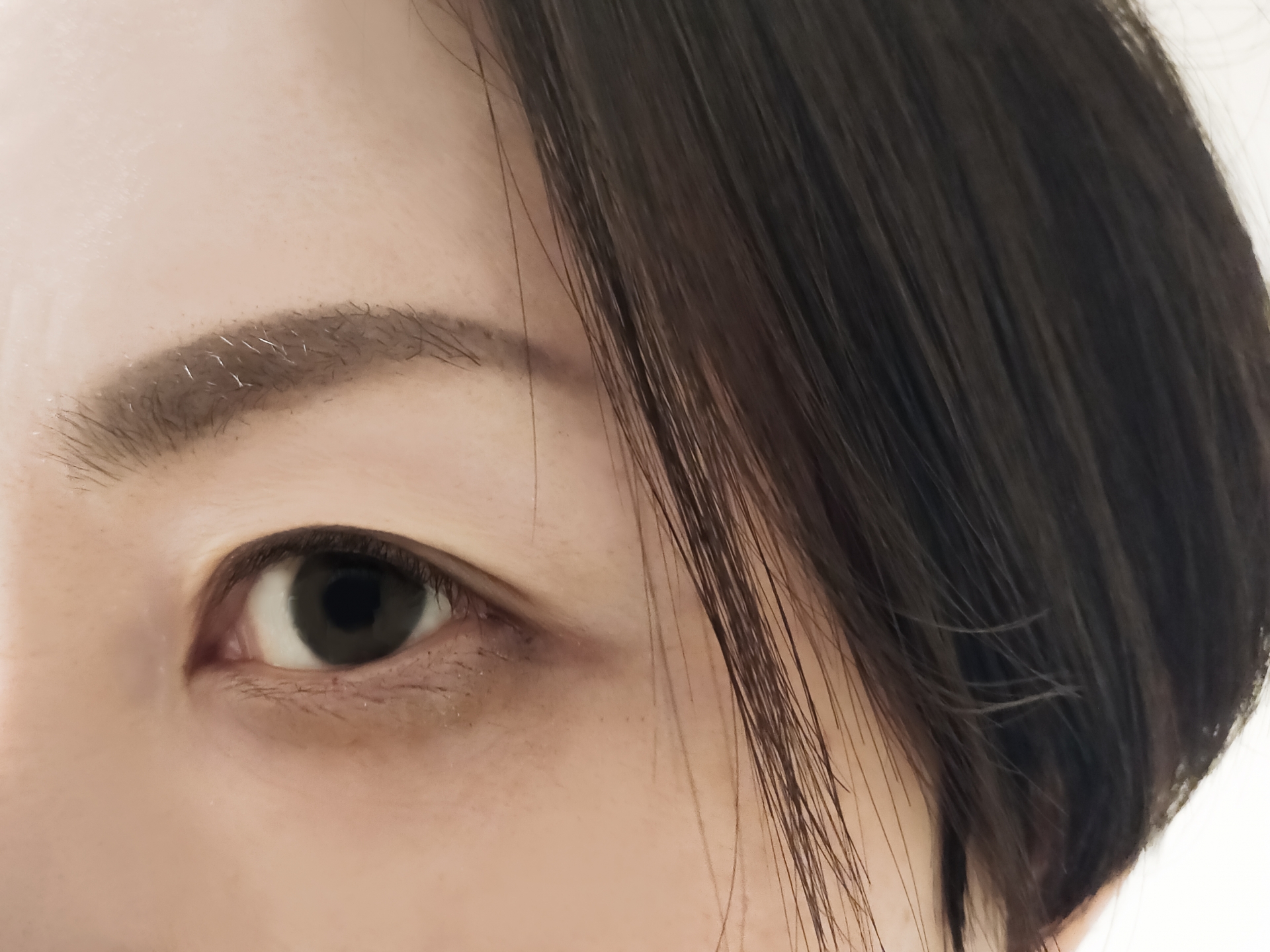 目の下のクマは警告だった ― 漢方薬サンシシと腸管静脈硬化症