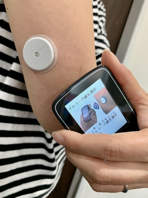 持続自己血糖測定器（CGM）のメリットとデメリット：最新の医学的知見に基づいた解説